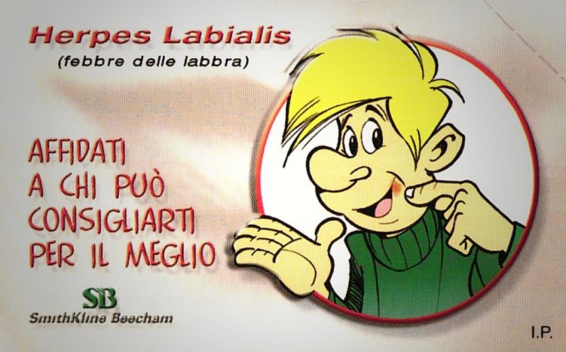 Herpes Labialis